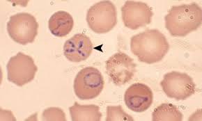 In The Beginning,&nbsp;Babesia